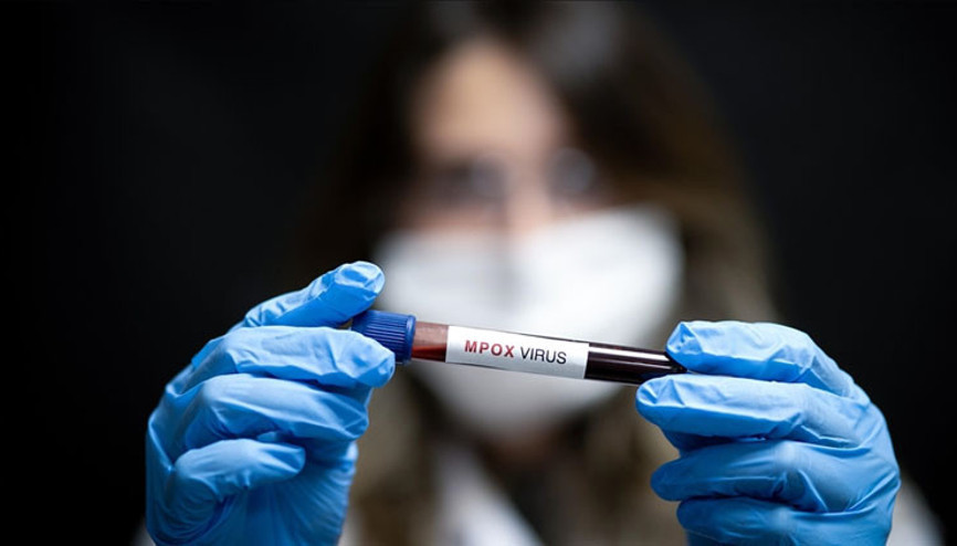 M-Çiçeği virüsü Afrikada yayılıyor... İki ülkede görüldü...