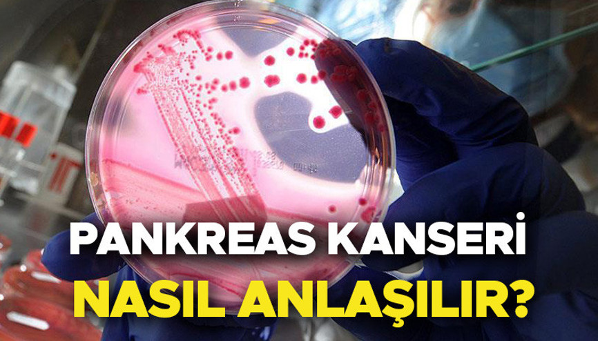Pankreas kanseri nedir, belirtileri nelerdir Survivor Hasanın hastalığı pankreas kanseri nasıl anlaşılır, neden olur, tedavisi var mı İşte risk artıran faktörler