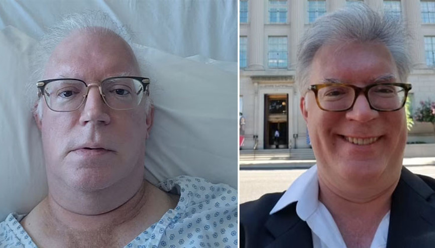 Bilim dünyasında devrim 4. evre kanseri yendi… Sadece 6 ay ömrü kalmıştı…