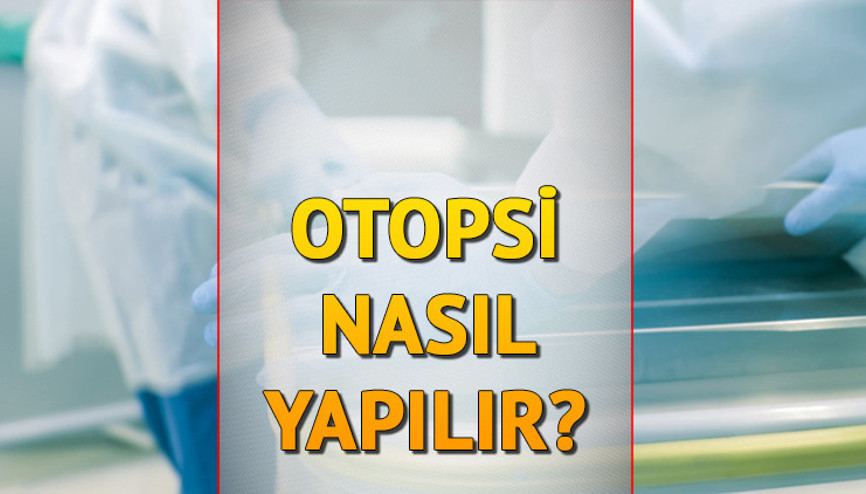 Otopsi nasıl yapılır, kaç saat sürer Otopsi nedir, ne demek Rojin olayı ile gündemde