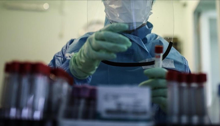 ABDde Lassa ateşi korkusu: Uzmanlar araştırıyor