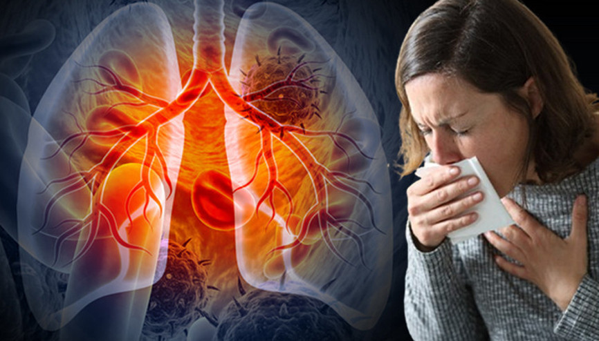 Dünyanın en ölümcül enfeksiyonunda artış rapor edildi Peki Türkiye’de durum ne Uzmanlar erken evrelerde soğuk algınlığına benzediği konusunda uyarıyor Dünyanın en ölümcül enfeksiyonunda artış rapor edildi Peki Türkiye’de durum ne Uzmanlar erken evrelerde soğuk algınlığına benzediği konusunda uyarıyor