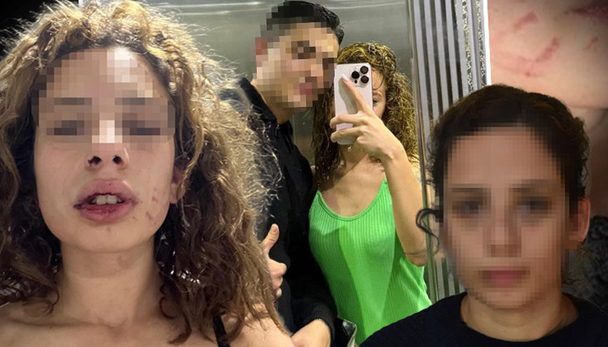 Konyada kız arkadaşına dehşeti yaşatmıştı Sevgiliden yüzsüz savunma: Kendi kendini yaraladı