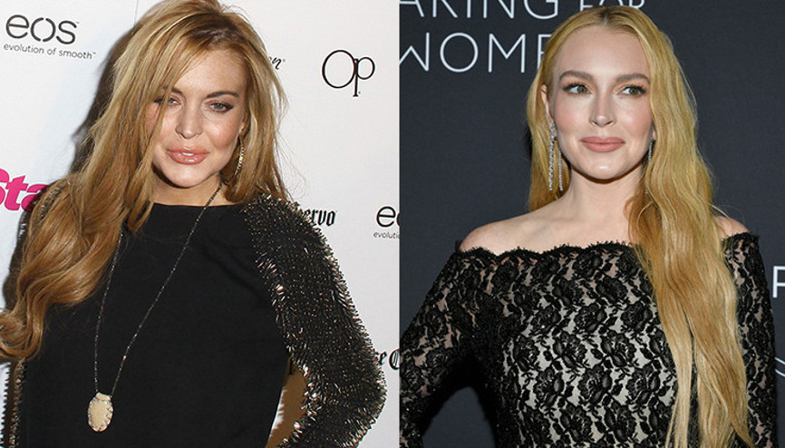 Estetik iddialarıyla gündemdeydi… Ünlü doktoruyla poz verdi