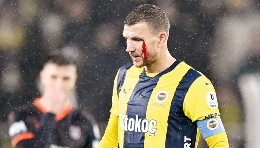 Kaşı yarıldı kendini yere atmadı... Dzeko duruşu örnek olsun