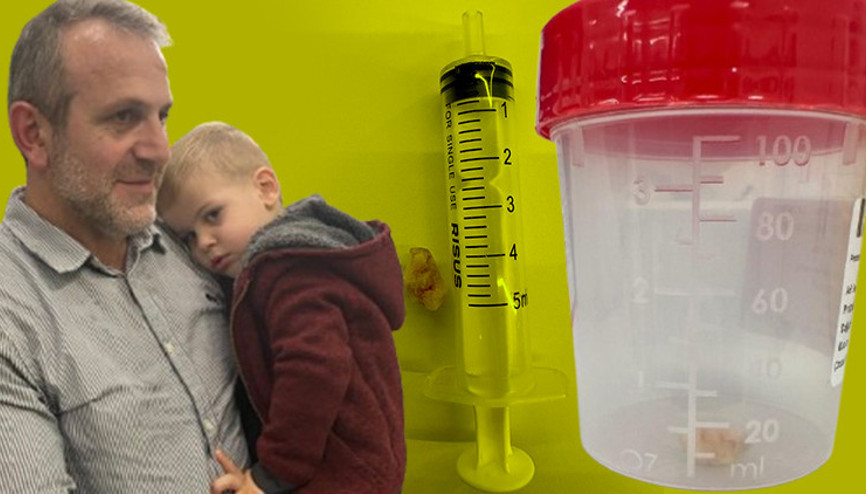 1,5 aydır öksürük nöbeti geçiriyordu, sebebi doktorları bile şaşırttı 1,5 aydır öksürük nöbeti geçiriyordu, sebebi doktorları bile şaşırttı