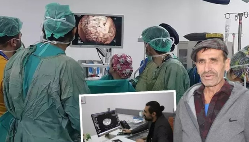 Yemekten sonra karnı şişip kusuyordu, 10 kattan fazla büyüyen midesi herkesi şaşırttı