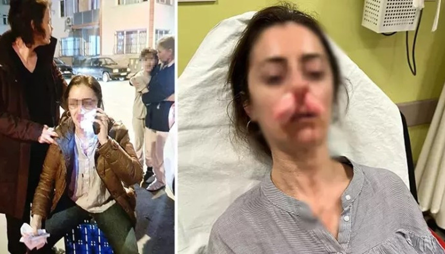 Edirne’de akılalmaz olay: Eşinin sevgilisine benzetip darbetti, pardon deyip kaçtı