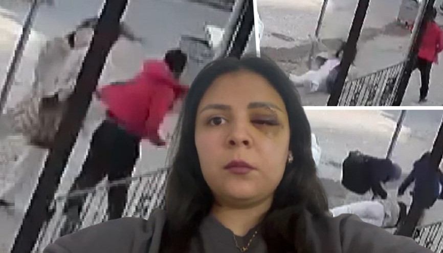 Sosyal medya bu olayı konuşuyor Genç kız, yaşadığı dehşeti anlattı: Sağ gözüme perde indi, sol gözümden kanlar aktı