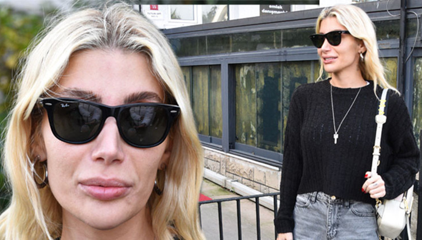 Dudağında ve kafasındaki şişlikler dikkat çekti İrem Dericiye ne oldu