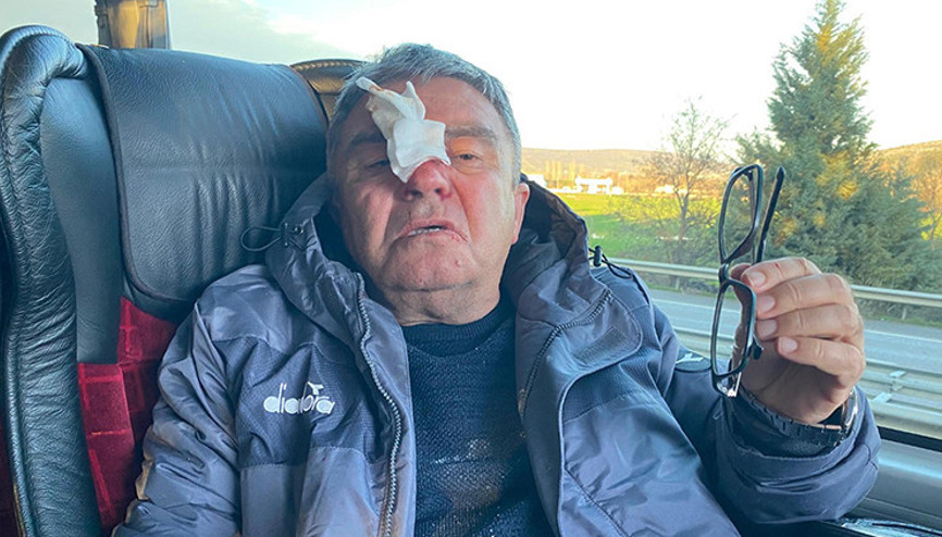 Uşakspor aracına çirkin saldırı Sportif Direktör Hasip Hayırcının burnu kırıldı