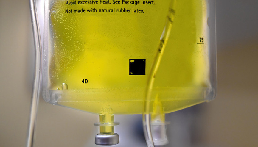 SARI SERUM TEHLİKESİ | ‘Ben yaptırıyorum bir şey olmadı’ demeyin 10 kez yaptırırsınız bir şey olmaz 11inci kez sizi canınızdan edebilir