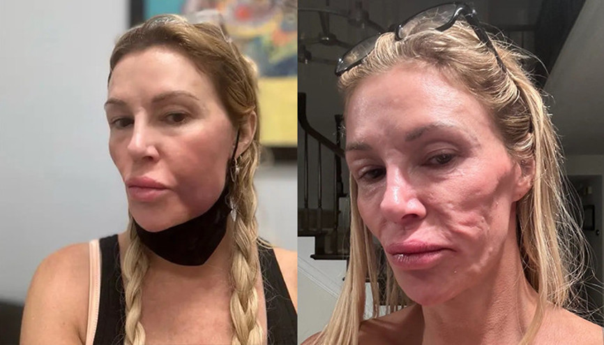 Ünlü oyuncunun hayatı kâbusa döndü… Yüzüne yerleşen ‘parazitler’ yüzünden tanınmaz hale geldi