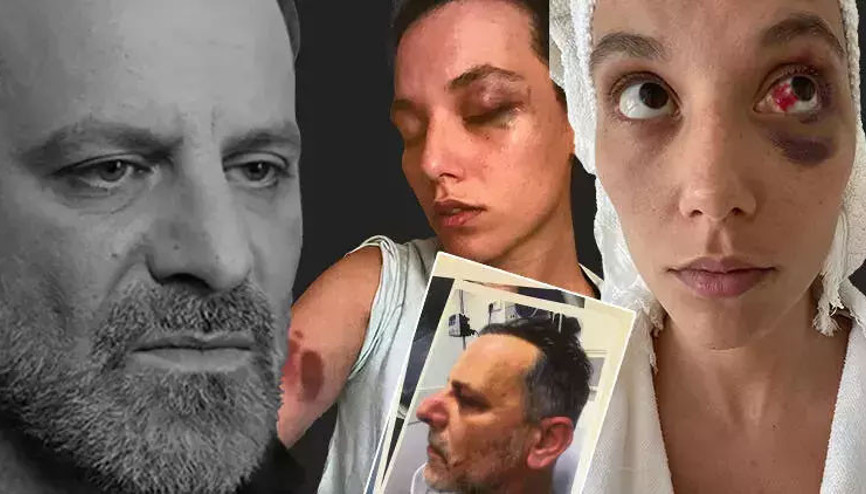 Şiddet iddiasıyla yargılanıyordu... Ozan Güvenin hapsi istendi