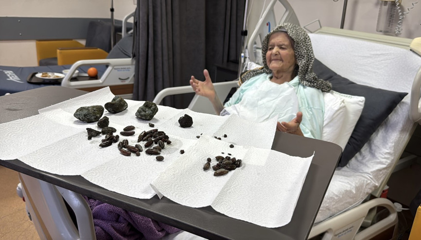 Böylesi görülmedi Midesinden 63 çekirdek çıkarıldı