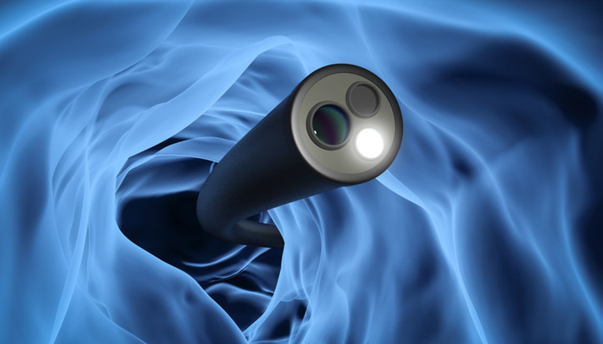 Endoskopi riskli bir işlem mi Bağırsak veya midede oluşan delinmeyi erkenden fark etmek hayati önem taşıyor