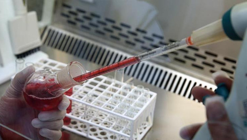 Bilinmeyen hastalık alarma geçirdi: Afrika ülkesinde çok sayıda ölü