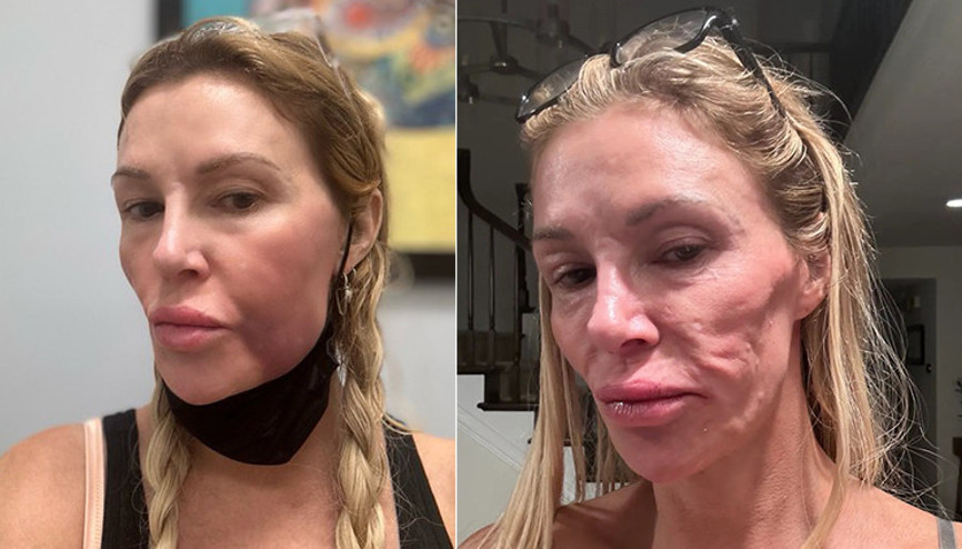 Ünlü oyuncunun büyük çaresizliği… Doktorlar sebebini bulamıyor… ‘Yüzüm eriyip gitti, perişanım’