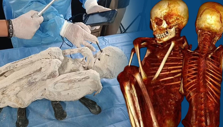 ‘Uzaylı mumyaları’ gerçek mi Bilim dünyasında tartışma yaratan yeni bulgular… ‘Karaciğerini parçalayan bir bıçak darbesi var’ ‘Uzaylı mumyaları’ gerçek mi Bilim dünyasında tartışma yaratan yeni bulgular… ‘Karaciğerini parçalayan bir bıçak darbesi var’