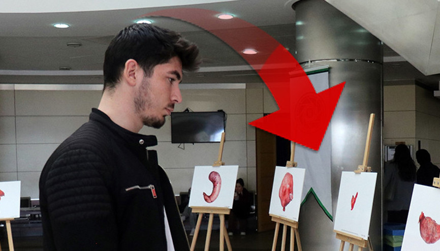 Doktor, ameliyatta hastalardan çıkan organları fotoğrafladı; ortaya bu kareler çıktı