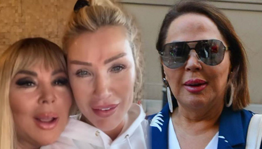 Safiye Soymandan estetik itirafı: Seda beni kobay olarak kullanıyor