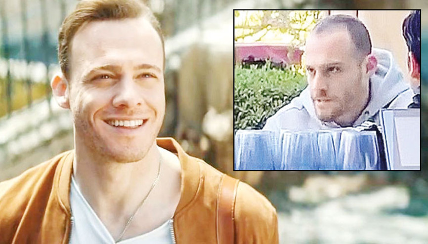 Kerem Bürsin saç ektirdi