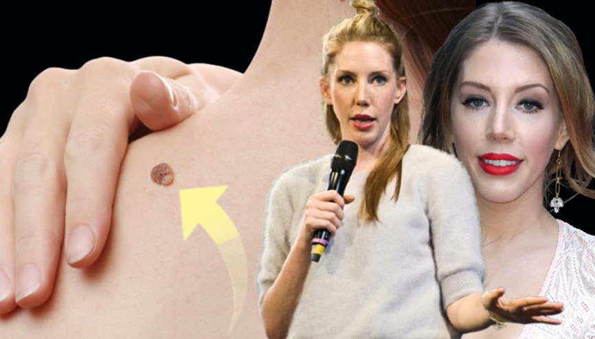 Ünlü komedyenin başına gelenler korkuttu: Kolunda fark etti, hayatının şokunu yaşadı Boyutu ve renkleri ne anlama geliyor