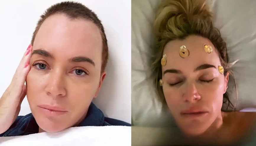 Ünlü oyuncunun kâbusu bitmiyor… Doktorlar beyninde 4 tümör daha buldu: Hayatım için savaşıyorum