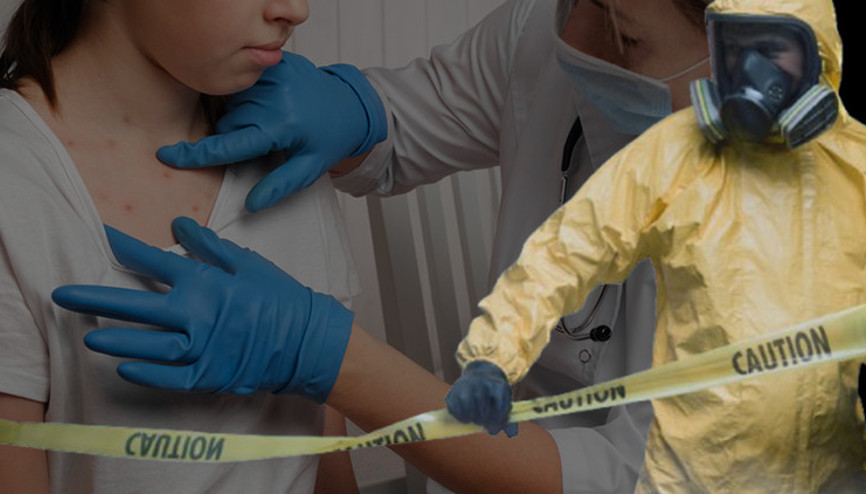 ABDde kızamık salgınından ikinci ölüm... Sayı endişe verici bir şekilde artıyor: Yüzyılın en kötü salgını olabilir