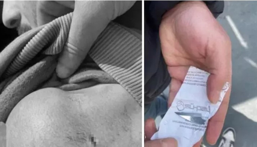 Milli sporcuya eski antrenörü neşterle saldırdı, vücudunda çok sayıda kesik oluştu