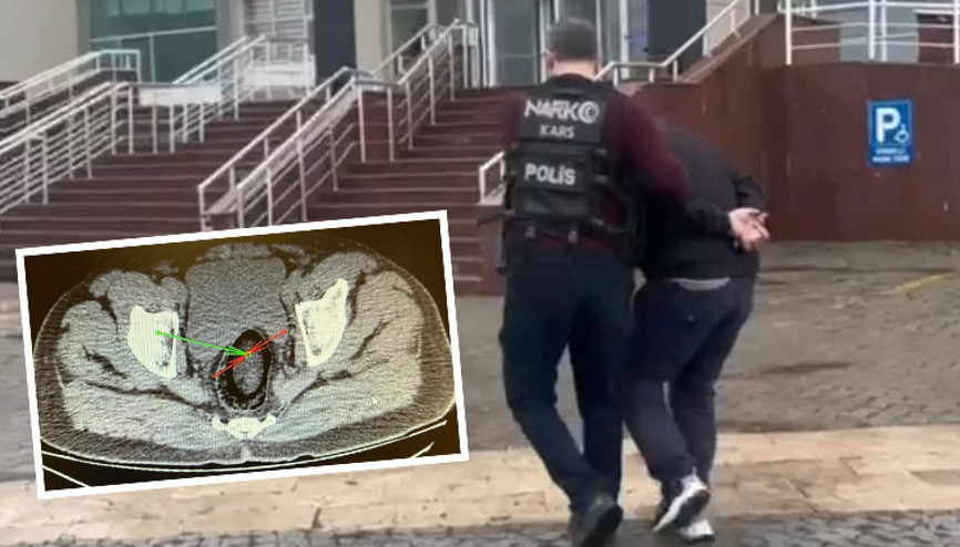 Polis, hareketlerinden şüphelenince gözaltına aldı: Röntgen çekilince ortaya çıktı