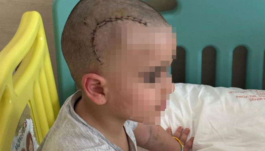 Kadıköyde anaokulunda korkunç kaza Küçük çocuk ölümden döndü