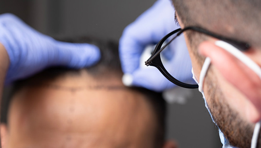 Ordudan 1 milyon sterlin çaldı, Türkiyede saç ektirdi