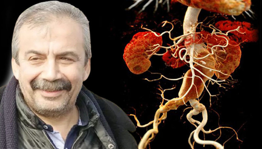 40-60 yaş arası en riskli grup Aort yırtılması kalp krizi ve felçle sonuçlanabilir