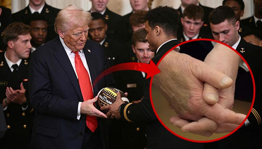 Beyaz Saray açıklama yapmıştı Trumpın elindeki gizemli morluk tekrar ortaya çıktı