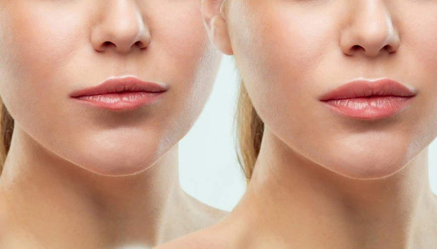 Gençlik üçgeni ve ağız çevresi yaşlanması: Gerçek nedenler ve doğal çözümler