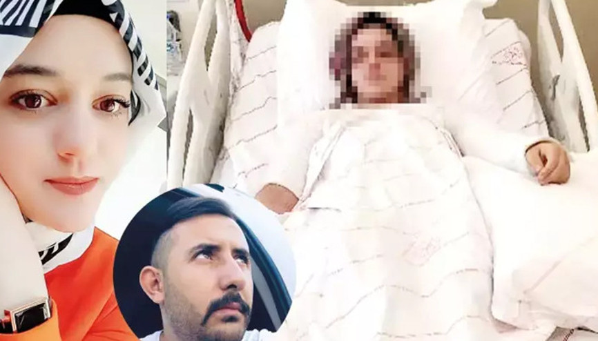 Konyada eski nişanlısının yüzüne kimyasal madde atmıştı Cezası belli oldu