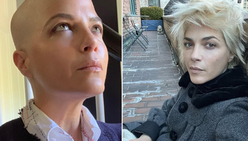 Teşhisi duyunca Hayatım bitti demişti... Bastonu attı, saçları uzadı... Ünlü oyuncu zorlu savaştan zaferle çıktı: Artık yeniden hayal kurmaya başlayacak