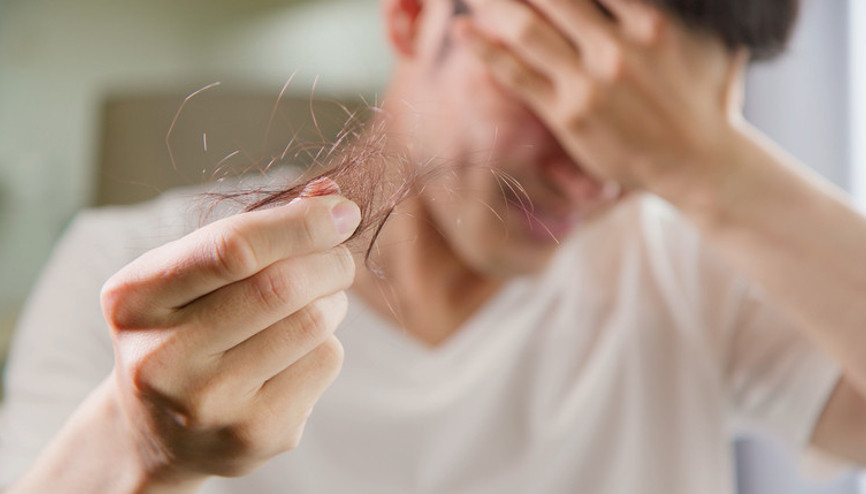 Genç yaşlarda daha etkili sonuçlar veriyor... Saç dökülmesine karşı PRP gerçekten işe yarıyor mu