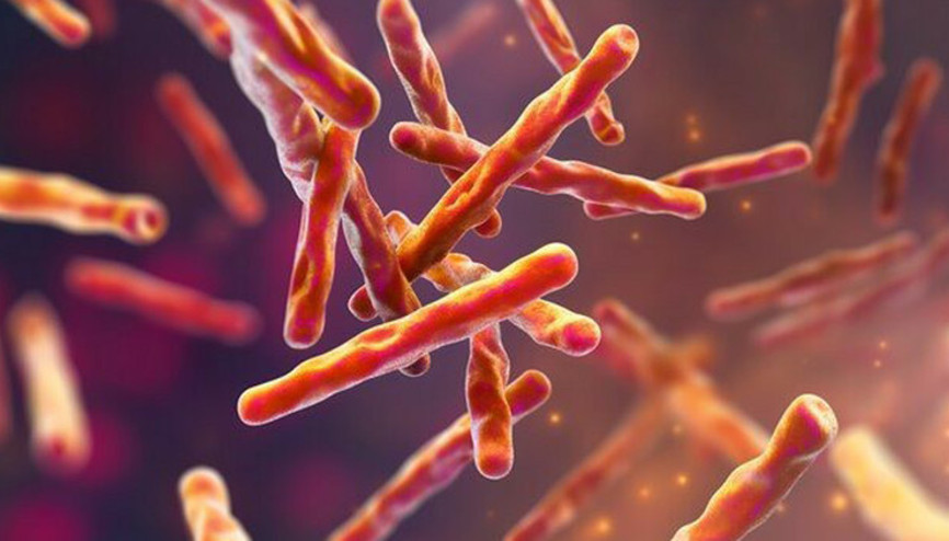 ABDde bir lisede tüberküloz tespit edildi