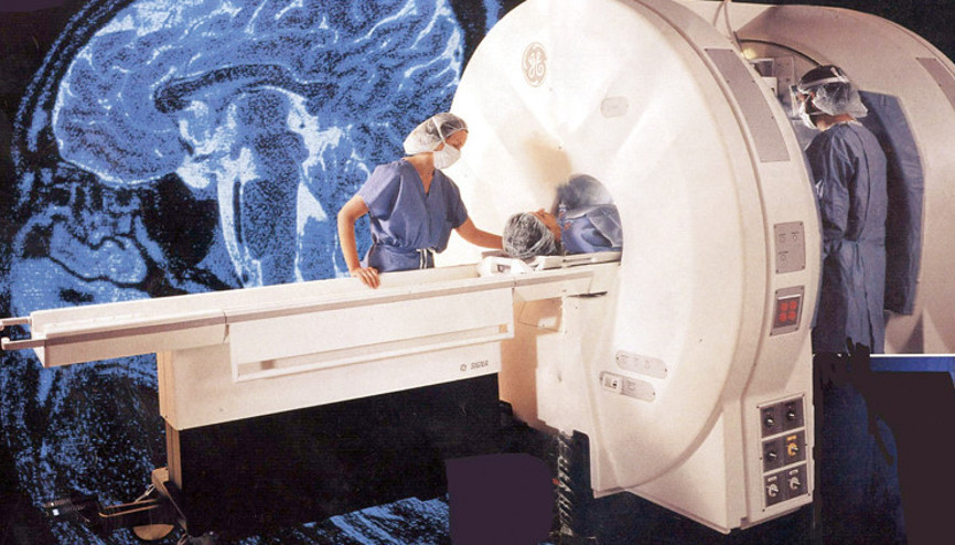 Yapay zekâ destekli MR cihazı ‘Alzheimer’ı erken sezecek
