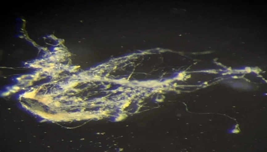 Bilim insanlarından şaşırtan keşif: Elektrik üretebilen bakteri sağlık endüstrisinde yeni icatların kapısını aralayabilir Bilim insanlarından şaşırtan keşif: Elektrik üretebilen bakteri sağlık endüstrisinde yeni icatların kapısını aralayabilir