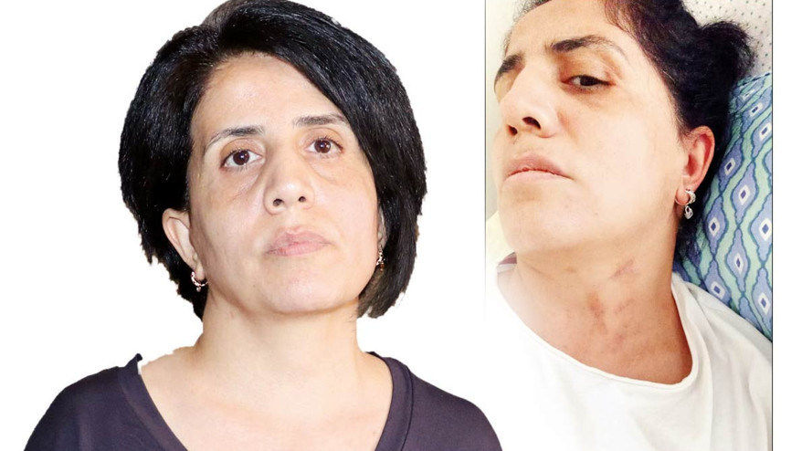 Sabiha’nın şiddet kabusu... Çocuğu olmuyor diye darp edildi Sabiha’nın şiddet kabusu... Çocuğu olmuyor diye darp edildi