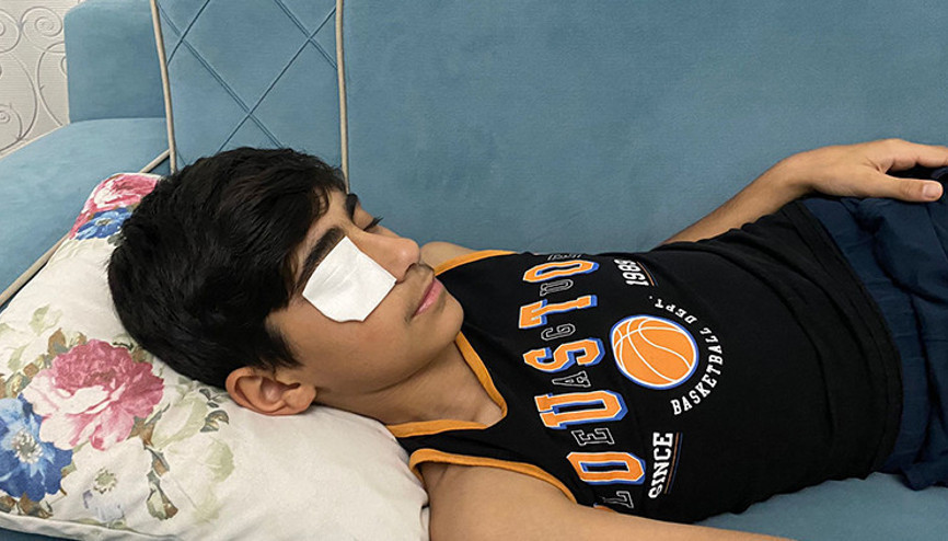 Neye uğradığını şaşırdı Yapıştırıcı sıçrayınca kapanan göz kapağı doktor müdahalesiyle açıldı