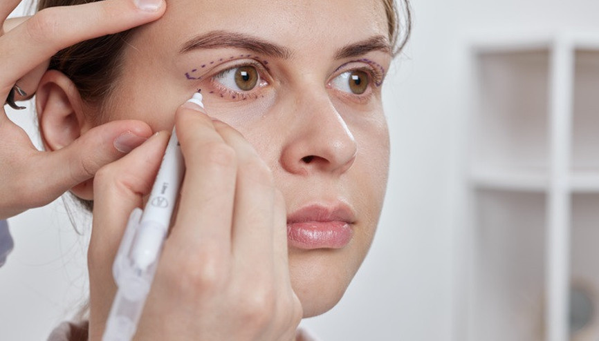 11 soruda göz kapağı düşüklüğü