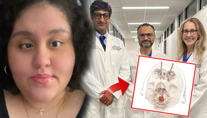 Tıp dünyası için yeni bir sayfa: Hastanın gözünden omurga kanseri tümörünü çıkardılar