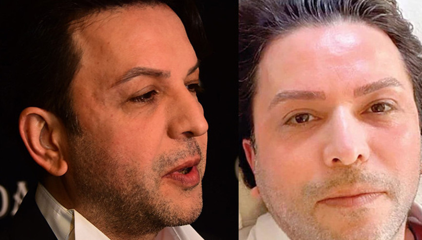 Ayrılık sürecinde döküldü...Sadece kaş yaptırdım
