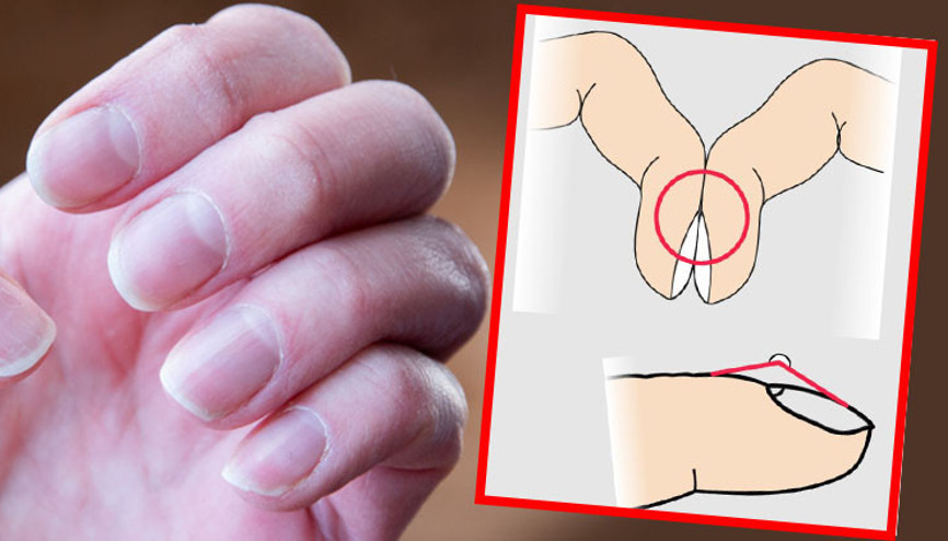 Ölümcül hastalığın sessiz işareti: Parmaklarda görülen bu değişikliğe dikkat Basit bir testle anlamak mümkün… Ölümcül hastalığın sessiz işareti: Parmaklarda görülen bu değişikliğe dikkat Basit bir testle anlamak mümkün…