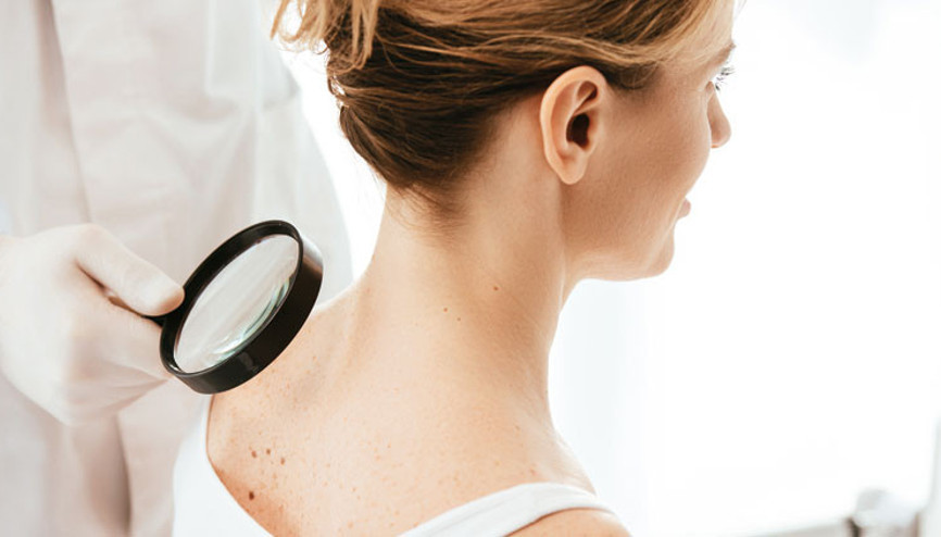 37 şehirde cilt kanseri taraması
