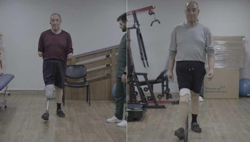 Üç uzvunu kaybetti ama pes etmedi, yeniden hayata tutundu Üç uzvunu kaybetti ama pes etmedi, yeniden hayata tutundu